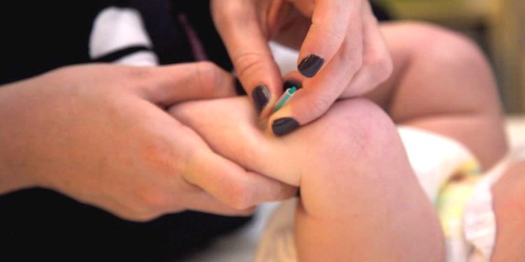 você sabia que é possível fazer acupuntura em bebês