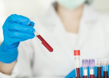 como interpretar o exame beta hcg quantitativo