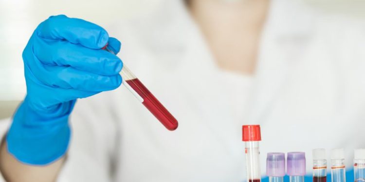 como interpretar o exame beta hcg quantitativo