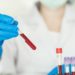 como interpretar o exame beta hcg quantitativo