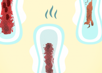 sangramento vaginal na gravidez não se deve confundir com menstruação