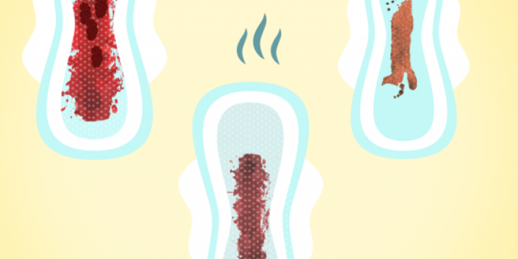 sangramento vaginal na gravidez não se deve confundir com menstruação