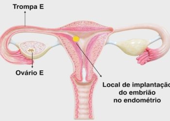 endométrio fino como tratar e ter a chance de engravidar