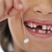 dente permanente o que ocorre se uma criança perde um deles
