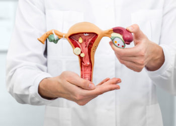 Pólipo uterino