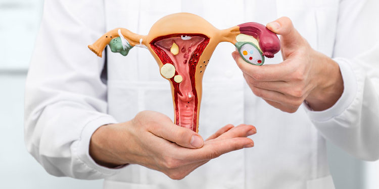 Pólipo uterino